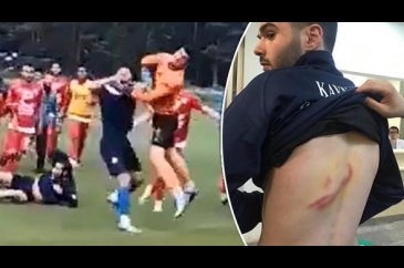 Amatör lig oyuncuları birbirine girdi