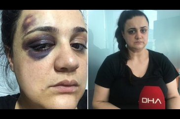 Evde cımbız yok diye...