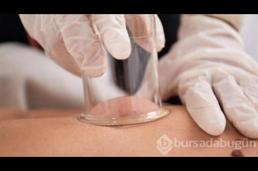 Hacamat steril şartlarda yapılmazsa hastalık bulaşabilir