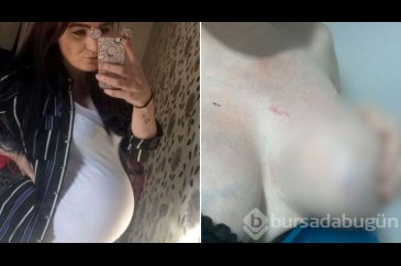 8 aylık hamile kadına ölümüne saldırdı