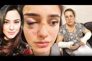 Ceren Kaplakarslan şiddet gördü ABD'ye gitti!