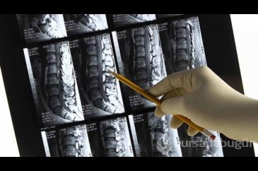 Osteoporoz hastalığına dikkat!
