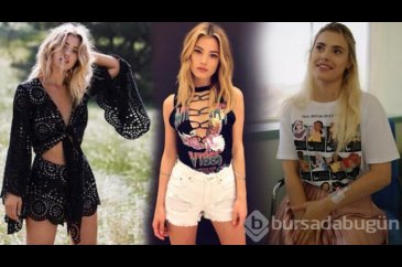 'Bacağını kesmeliyiz' denilen ünlü model mesleğine dönüyor!