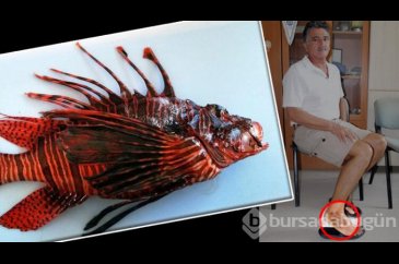 'Aslan balığı' az daha öldürüyordu!