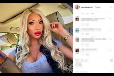 Yaptırdığı estetiklerle bambaşka birine dönüştü