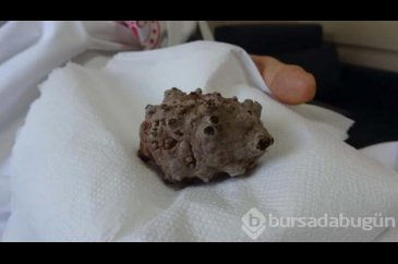 Doktorlar bile şaşırdı! 'Kendimi hafiflemiş hissediyorum'