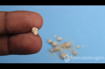 Böbrek taşı düşürenler limonlu su içerse bakın neler oluyor!