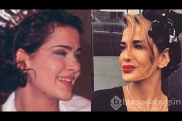 "2 yıl aynalara küstüm!"