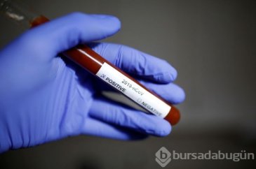 Koronavirüs bu kez Azerbaycan'da!