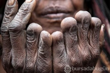 Böyle gelenek görülmedi! Sevdiği biri ölünce parmaklarını kesiyorlar