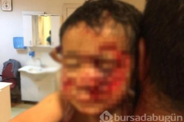 Köpek saldırısına uğrayan küçük Davut, kurtarılamadı