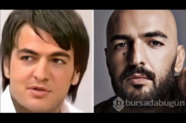 Soner Sarıkabadayı'nın bir zamanlar saçı varmış