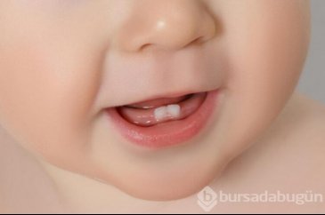 Bebeklerin diş çıkarma döneminde neler yapılmalı? 