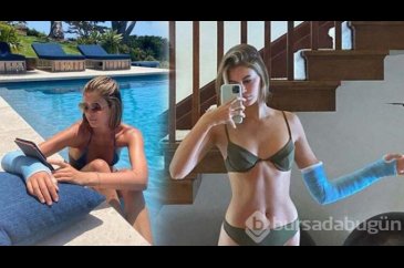 Kaia Gerber'in kolu kırıldı