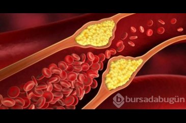 Bu karışım kolesterolü düşürüyor!