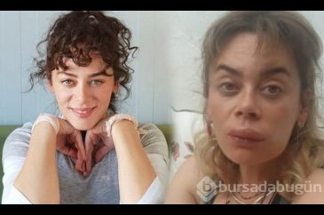 Demet Evgar: Arıların saldırısına uğradı