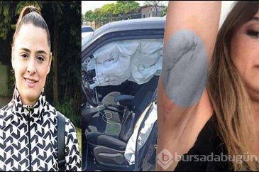 Sunucu Zeynep Tandoğan ölümden döndü