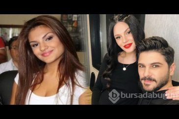 Almeda Abazi ekranlara dönüyor