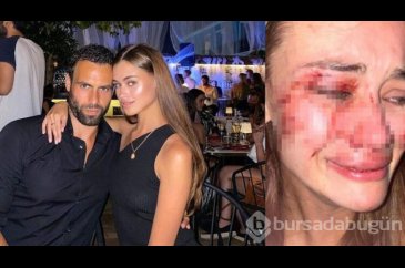 Kanlar içindeki fotoğrafı ile olay olan Daria Kyryliuk, Bodrum'da o...
