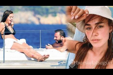 Bensu Soral nazara geldi! Tatilde talihsiz kaza
