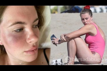 Ireland Baldwin darbedildikten sonra ilk kez görüntülendi
