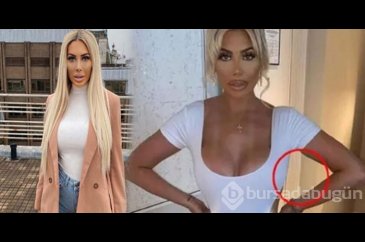 Chloe Ferry 'photoshop'un ayarını kaçırdı!
