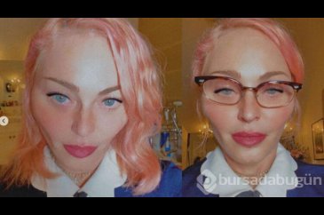 Madonna, son hali ile bu da kim böyle dedirtti!