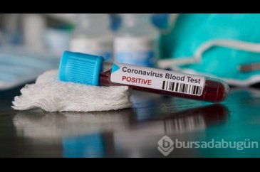 Corona virüs testi evde yapılır mı?
