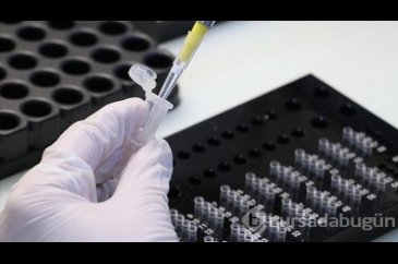 13 soruda, PCR testi hakkında tüm merak edilenler...