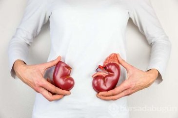 Böbrek taşı riskinizi azaltacak öneriler!
