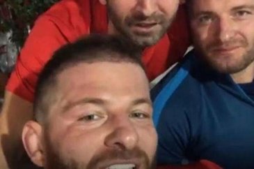 İsmail Balaban estetik yaptırdı
