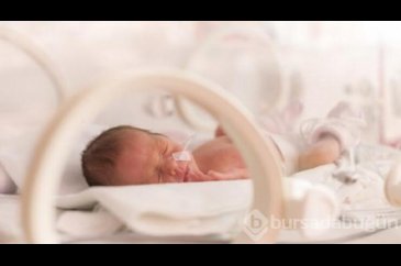 Prematüre retinopatisi her 4 bebekten 1'inde görülüyor!
