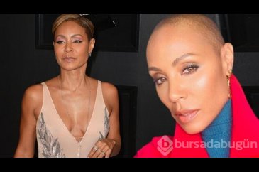 Jada Pinkett Smith sağlık sorununu anlattı