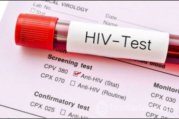 AIDS/HIV ile mücadelede önemli gelişme: Virüsü tamamen ortadan kald...
