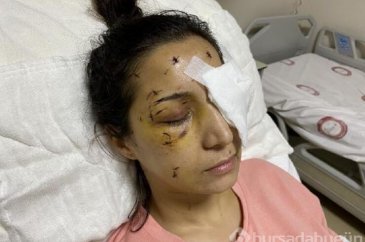 Yengesini bıçaklayıp kör etti
