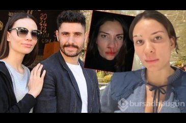Mihriban Hurmacı yaşadığı şiddeti anlattı: Özer beni kendisine muht...