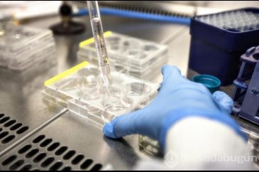 HIV pozitif bir kadın virüsten tamamen kurtuldu!
