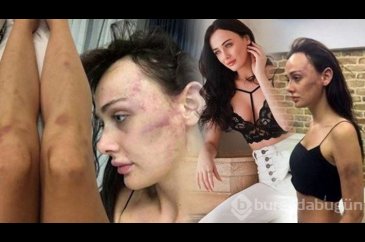 Sevgilisi Sırp model Tanja Dukiç'i dövdüğü iddia edilen yönetmen Ça...