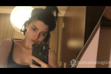Merve Boluğur'dan dikkat çeken botoks cevabı