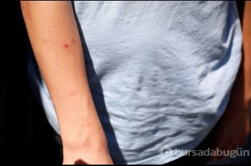 İstanbul'da 'Aedes' tehdidi