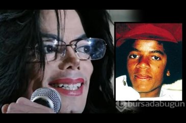 Micheal Jackson'ın 50 yıllık 'estetik' sırrı