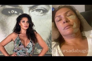Tuğba Altıntop yaşadığı dehşeti anlattı: Yüzümde 50-60 dikiş var
