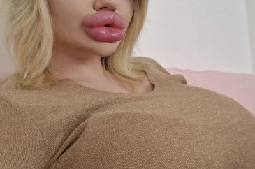 Dünyanın en büyük dudaklı kadını Andrea Ivanova