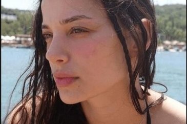 Leyla Tanlar'ın estetiksiz hali şoke etti!
