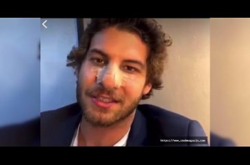 Mustafa Mert Koç burnuyla ilgili gerçeği açıkladı
