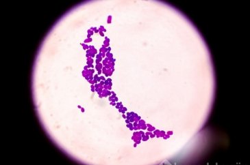 Yeni ölümcül salgın: Candida auris