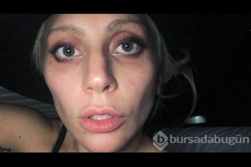 Ünlü şarkıcı Lady Gaga'nın köpek davası devam ediyor