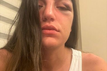 Gizem Akbaş'ı darp eden sanığın cezası belli oldu
