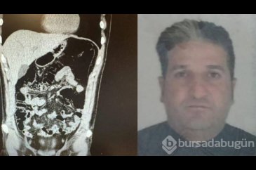 Midesinde eroin bulunan kurye İranlı iş insanı çıktı
