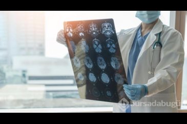 "İlk önemli ipucu": Alzheimer hastalarında beyin hücrelerinin neden...